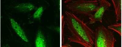 Immunocytochemistry/ Immunofluorescence: GPS2 Antibody [NBP2-14970]
