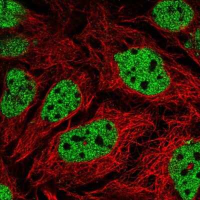 Immunocytochemistry/ Immunofluorescence: GPS2 Antibody [NBP2-57050]