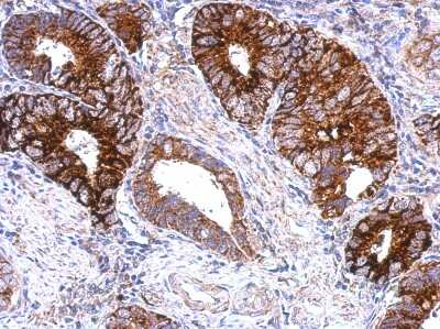 Immunohistochemistry-Paraffin: GPS2 Antibody [NBP2-14970]