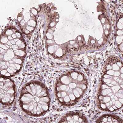 Immunohistochemistry-Paraffin: GPS2 Antibody [NBP2-57050]