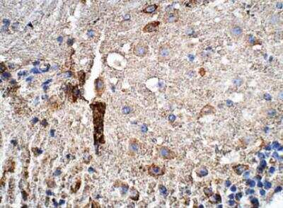 Immunohistochemistry-Paraffin: GPS2 Antibody [NBP3-12314]