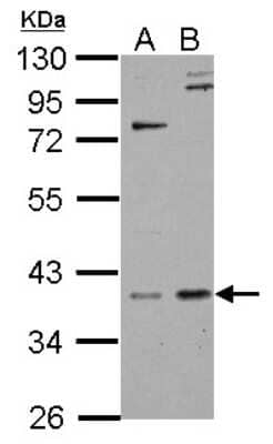 Western Blot: GPS2 Antibody [NBP2-14970]