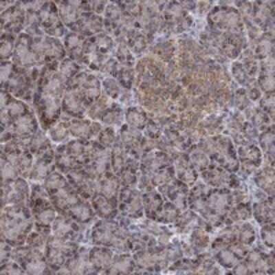 Immunohistochemistry-Paraffin: GPSM1 Antibody [NBP3-17859]