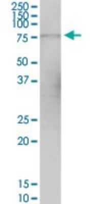 Western Blot: GPSM1 Antibody [H00026086-B01P]