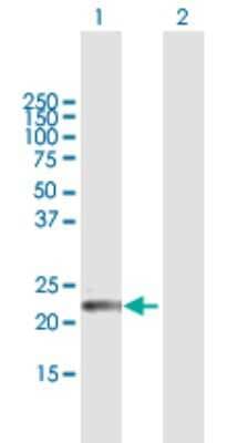 Western Blot: GPSM1 Antibody [H00026086-B01P]