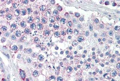 Immunohistochemistry-Paraffin: GPSM2 Antibody [NB100-57096]