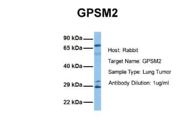 Western Blot: GPSM2 Antibody [NBP1-53125]