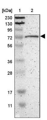 Western Blot: GPSM2 Antibody [NBP1-85231]