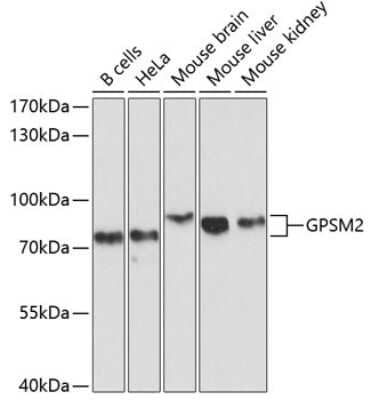 Western Blot: GPSM2 AntibodyAzide and BSA Free [NBP3-05001]