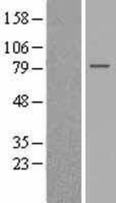 Western Blot: GPSM2 Overexpression Lysate [NBL1-11310]