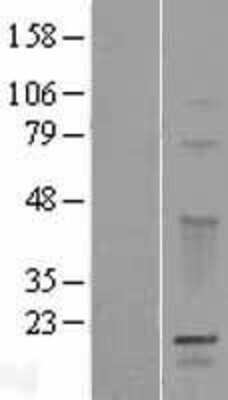 Western Blot: GPSM3 Overexpression Lysate [NBP2-06471]