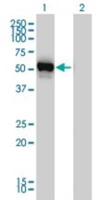 Western Blot: GPT Antibody (4E2) [H00002875-M03]