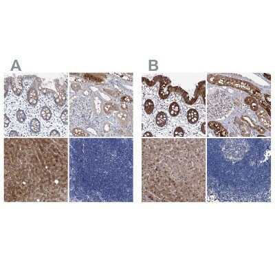 Immunohistochemistry-Paraffin: GPT Antibody [NBP1-89110]