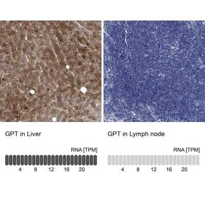 Immunohistochemistry-Paraffin: GPT Antibody [NBP1-89110]