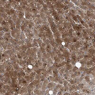 Immunohistochemistry-Paraffin: GPT Antibody [NBP1-89110]