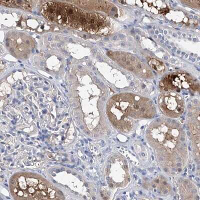 Immunohistochemistry-Paraffin: GPT Antibody [NBP1-89110]