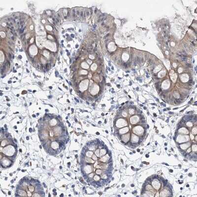 Immunohistochemistry-Paraffin: GPT Antibody [NBP1-89110]