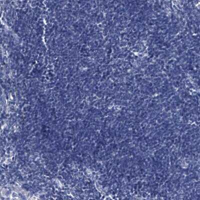 Immunohistochemistry-Paraffin: GPT Antibody [NBP1-89110]