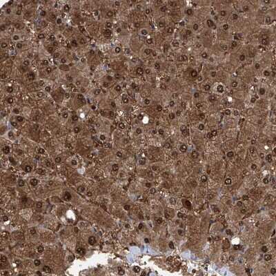 Immunohistochemistry-Paraffin: GPT Antibody [NBP1-89111]