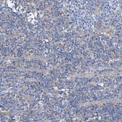 Immunohistochemistry-Paraffin: GPT Antibody [NBP1-89111]