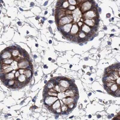 Immunohistochemistry-Paraffin: GPT Antibody [NBP1-89111]