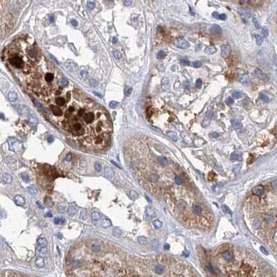 Immunohistochemistry-Paraffin: GPT Antibody [NBP1-89111]
