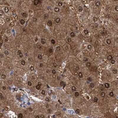 Immunohistochemistry-Paraffin: GPT Antibody [NBP1-89111]