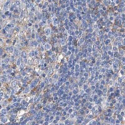 Immunohistochemistry-Paraffin: GPT Antibody [NBP1-89111]