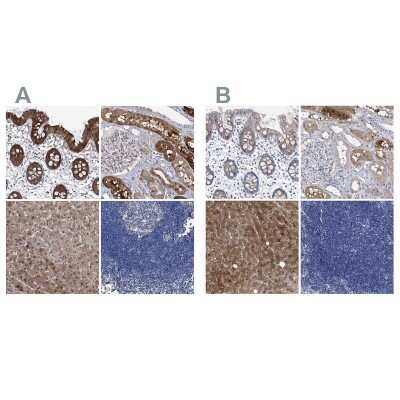 Immunohistochemistry-Paraffin: GPT Antibody [NBP1-89111]