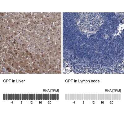 Immunohistochemistry-Paraffin: GPT Antibody [NBP1-89111]
