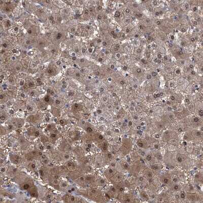 Immunohistochemistry-Paraffin: GPT Antibody [NBP1-89111]