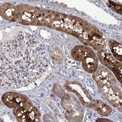Immunohistochemistry-Paraffin: GPT Antibody [NBP1-89111]