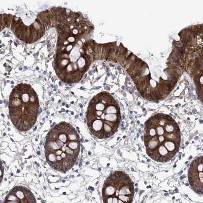Immunohistochemistry-Paraffin: GPT Antibody [NBP1-89111]