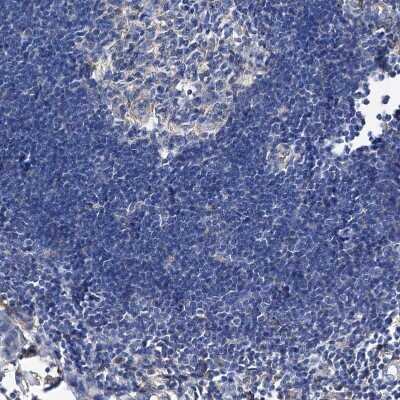 Immunohistochemistry-Paraffin: GPT Antibody [NBP1-89111]