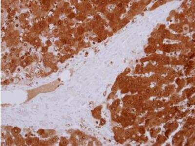 Immunohistochemistry-Paraffin: GPT Antibody [NBP2-16731]