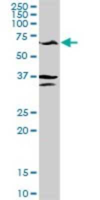 Western Blot: GPT Antibody [H00002875-D01P]