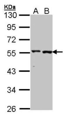 Western Blot: GPT Antibody [NBP1-31525]