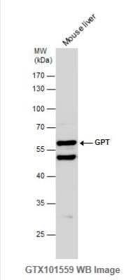 Western Blot: GPT Antibody [NBP1-31525]