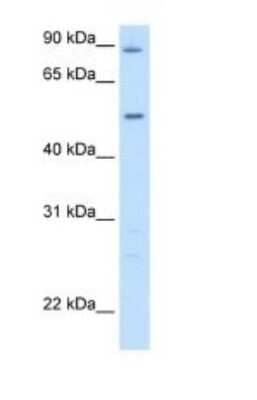 Western Blot: GPT Antibody [NBP1-53177]