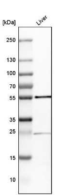 Western Blot: GPT Antibody [NBP1-89111]