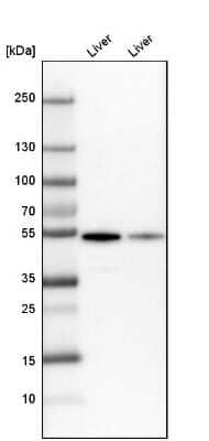 Western Blot: GPT Antibody [NBP1-89111]