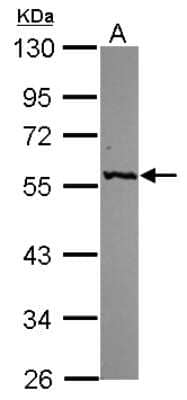 Western Blot: GPT Antibody [NBP2-16731]