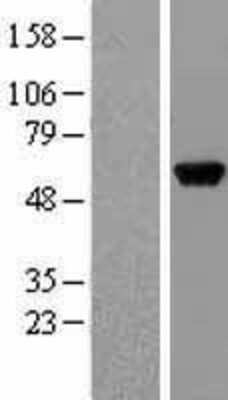 Western Blot: GPT Overexpression Lysate [NBL1-11312]