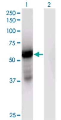 Western Blot: GPT2 Antibody (7A11) [H00084706-M04]