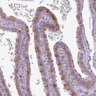 Immunohistochemistry-Paraffin: GPT2 Antibody [NBP2-14072]