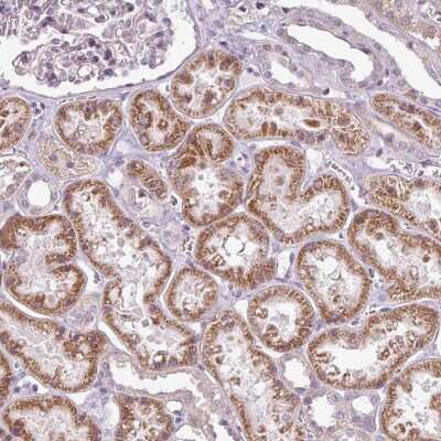 Immunohistochemistry-Paraffin: GPT2 Antibody [NBP2-14072]