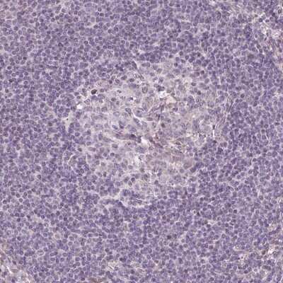 Immunohistochemistry-Paraffin: GPT2 Antibody [NBP2-14072]