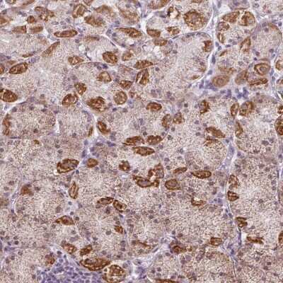 Immunohistochemistry-Paraffin: GPT2 Antibody [NBP2-14072]