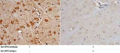 Immunohistochemistry-Paraffin: GPT2 Antibody [NBP2-98413]