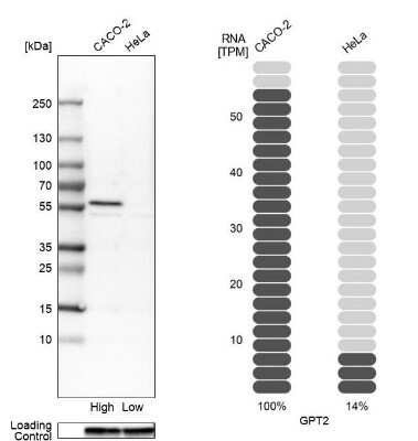 Western Blot: GPT2 Antibody [NBP2-14072]